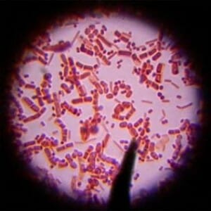 Инфекции под микроскопом
