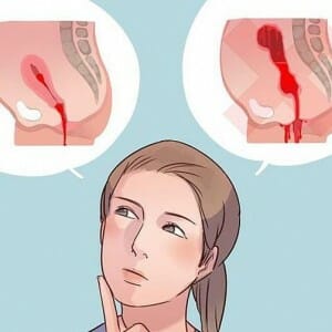 Девушка и маточное кровотечение рисунок