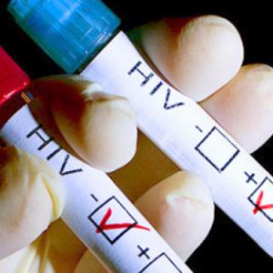 Анализы крови на ВИЧ