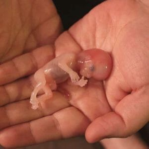 Эмбрион на ладони