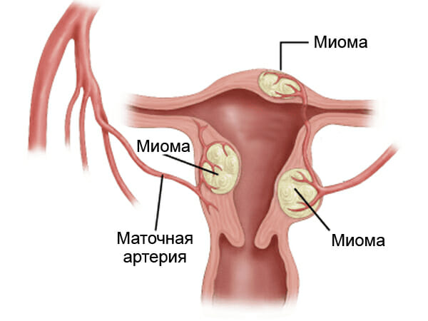 Менструация два раза за цикл thumbnail