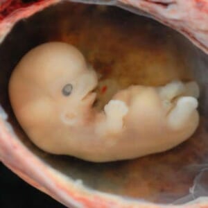 Эмбрион
