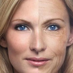 На пол лица старение кожи