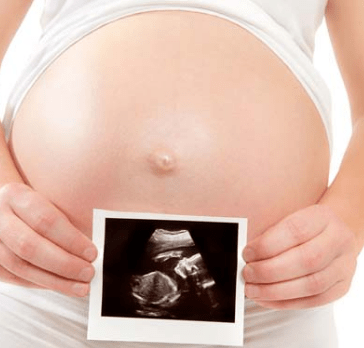 Беременная держит снимок УЗИ
