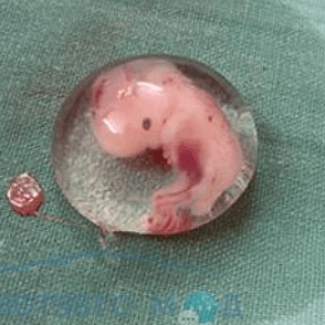 Эмбрион в пузыре
